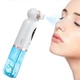 Вакуумный аппарат Face Slimmer для чистки кожи лица и пор - изображение 1