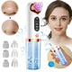 Вакуумный аппарат Face Slimmer для чистки кожи лица и пор - изображение 9