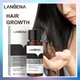 Імбирне масло для росту та від випадіння волосся LANBENA 20 ml - зображення 3