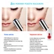 Микротоковый массажер EYE ANTI WRINKLE Ms.W прибор для лифтинга омоложения и подтяжки кожи вокруг глаз ST-804 - изображение 4