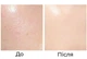 Набор Кушон Images Concealer + База под макияж Baizton Isolation Contour Color + Тушь для ресниц Vibely 4D Xpress Control - изображение 5