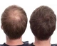 Загущувач для волосся (пудра) Toppik Hair Building Fibers світло-коричневий light brown ( код: lb-04 ) - зображення 2