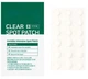 Заживляющие патчи против прыщей SOME BY MI 30 Days Miracle Clear Spot Patch 18шт (10 мм-9 шт. 12 мм-9 шт) - изображение 3
