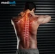Подушка Sonex ортопедическая Medisoft 50х70 см (SO102055) - изображение 6