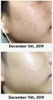 Тонизирующая сыворотка для проблемной кожи AXIS-Y Dark Spot Correcting Glow Serum Миниатюра 5 мл - изображение 3