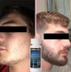 Minoxidil Kirkland для роста волос и бороды 6 флаконов + дозатор - изображение 2