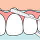 Nić dentystyczna do mostów i implantów TePe (672250) 30 szt (7317400014289) - obraz 5