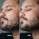 5% Minoxidil Kirkland для росту волосся та бороди (3 флакона + дозатор) - зображення 3