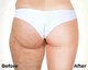 Антицелюлітні обгортання з ефектом розігріву - Hillary Anti-cellulite Bandage Warming Effect 100g (1066812-31020512) - зображення 3