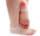 Протекторы на пятку Valgus Pro, 2шт, силикон (Бурсопротектор для пятки от трещин и мозолей) - изображение 5