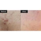 Сыворотка-бустер для лица с микроиглами VT Cosmetics Reedle Shot 100, 50 мл - изображение 6