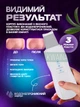 Аппарат для ультразвуковой чистки лица, скрабер, массажер для лица, фонофорез, лифтинг и увлажнение, очищение, борьба с морщинами, белый - изображение 4