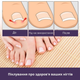 Набор пластырей для коррекции вростающих ногтей Elastic Toenail Correction Sticker (50 pcs) - изображение 7