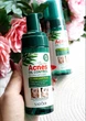 Очищающая пенка-мусс Sadoer Acnes для проблемной кожи и кожи с проявлениями акне 150 мл - изображение 2