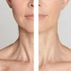 Ліфтинг-стік для шиї Medi Peel Premium Naite Thread Neck Stick 20 г - зображення 2