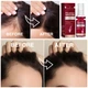 Миноксидил спрей для роста волос женщин Yzmoffer 5% Minoxidil Hair Growth Spray For Women 60 мл - изображение 5