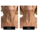Набор CurrentBody Skin LED Light Therapy Face Neck Kit для лица, шеи и зоны декольте - изображение 7