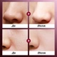Очищающая пузырьковая маска для лица Sadoer Azelaic Acid Purifu Bubble Mask с азелаиновой кислотой 4г - изображение 7