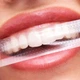 Відбілюючі смужки AIMED Teeth Whitening Strips 28 шт на 14 процедур Смак Манго - зображення 9