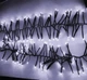 Уличная гирлянда бахрома Фейерверк 240 LED, 2,5x0,6м, черный каучук, 220В, IP65, Холодный белый - изображение 5