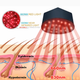 Инфракрасная шапка от облысения, лазерная терапия роста волос, шапка для лечение выпадения волос и кожи головы, лазерный шлем от облысения - изображение 4