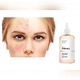 The Ordinary Glycolic Acid 7% Toning Solution Тонік із гліколевою кислотою - зображення 3