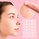 Пластырь от прыщей и акне 72шт Acne Patch / Косметические патчи от бородавок и папиллом / Пластыри наклейки - изображение 1