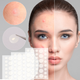 Пластырь от прыщей и акне 72шт Acne Patch / Косметические патчи от бородавок и папиллом / Пластыри наклейки - изображение 2