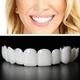 Знімні вініри для зубів Veneers smile, накладні зуби верх і низ у кейсі - зображення 5