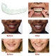 Знімні вініри для зубів Veneers smile, накладні зуби верх і низ у кейсі - зображення 6