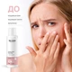 Відлущувальний тонер для обличчя ReCare Exfoliating Face toner, 150 мл (289622) - зображення 2