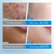 Патчі от акне у формі зірки SADOER Star+Round Acne Patch, 1х75 шт - изображение 5