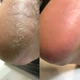 Кератолитик для ног Nails Of The Day Podology+ с мочевиной 20%, 100 мл - изображение 3