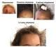 Набор для лечения шрамов Improscar Stick дневной и ночной стики с SPF 50 - изображение 7