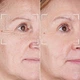 Светодиодная маска CurrentBody Skin LED Light Therapy Face Mask: Series 2 нового поколения - изображение 10