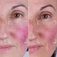 Светодиодная маска CurrentBody Skin LED Light Therapy Face Mask: Series 2 нового поколения - изображение 12