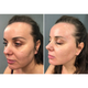 Микротоковый лифтинг-массажер для тела MEDICA+ Skin Lifting 5.0 - изображение 7