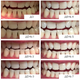 Отбеливающие полоски MEDICA+ 3DWhite Strips - изображение 13