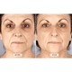 Світлодіодна маска CurrentBody Skin Mask LED Visage: Series 1 покоління - зображення 8
