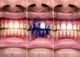 Корректор цвета зубов SmileKit V34 30 мл (405541) - изображение 9