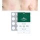 Патчи против прыщей с центеллой - VT Cosmetics VT SPOT PATCH, 48 шт - изображение 2