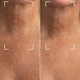 Светодиодная маска CurrentBody Skin LED Neck and Dec Perfector для шеи и декольте: Series 1 - изображение 5