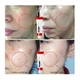 Осветляющий крем против пигментации Medi-Peel Melanon X Cream 30 ml - изображение 2