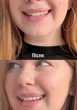 Ополіскувач для ротової порожнини з ефектом відбілювання зубів Solident Color corrector liquid 250 ml - зображення 2