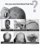 Спрей для росту волосся Pure Hair Growth Spray 30 мл Імбир Женьшень Горець Натуральний веганський засіб - зображення 7