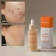 Освітлювальна сироватка з ніацинамідом Blithe Targeted Blemish Niacinamide 5.0 30 ml - изображение 2