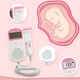 Доплер фетальний Baby Monitor ультразвуковий детектор серцебиття кишеньковий 2 5 МГц універсальний білий (300) - зображення 5