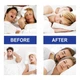 Полоски для обеспечения носового дыхания во сне Sleep Strips Для всей семьи 30 шт PK053 - изображение 7