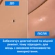 Шпаклівка еластична для шкіри усунення дефектів RESTORE Flexifil 15мл Чорний - зображення 3