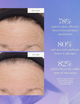 Сироватка для обличчя Kora Organics Plant Stem Cell Retinol Alternative антивікова 10 мл (9342759006119) - зображення 5
